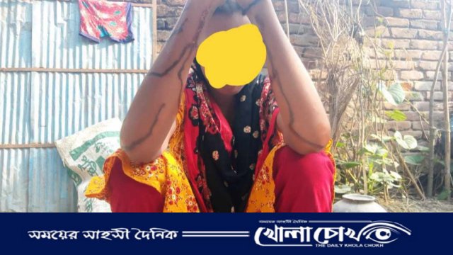 মিঠাপুকুরে সাজানো ধর্ষণ মামলার পর এবার সাজানো এসিড নিক্ষেপের অভিযোগ