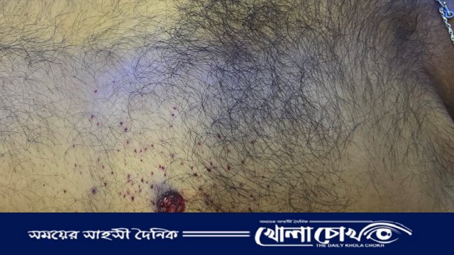 সোনাইমুড়ীতে যুবককে গুলি করে হত্যা