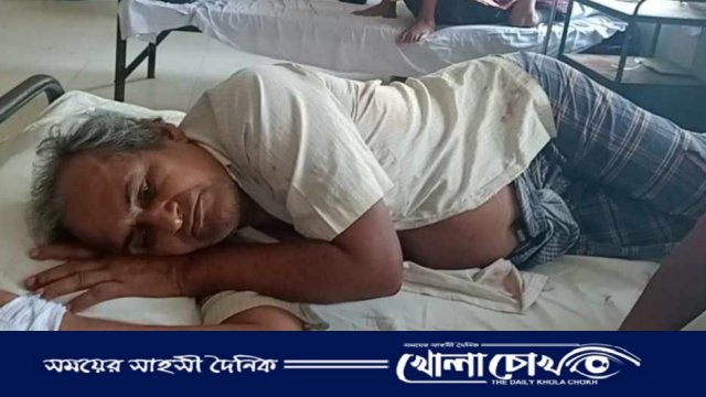 ভাঙ্গায় সংখ্যালঘু পরিবারের প্রবীণ সদস্যের উপর হামলাঃ হাসপাতালে ভর্তি