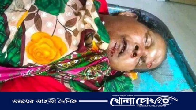 নওগাঁর রাণীনগরে সড়ক দুর্ঘটনায় অজ্ঞাত নারীর মৃত্যু 