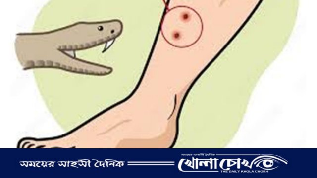 নোয়াখালীতে এবার সাপের দংশনে হাসপাতালে ২৫৫ জন