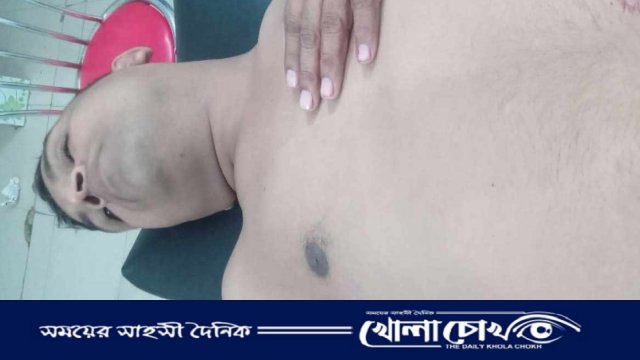 নোয়াখালীতে চুরির দ্বন্দ্বে অ্যাম্বুলেন্স চালককে ছুরিকাঘাতে হত্যা  