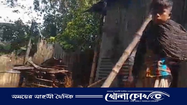 ভাঙ্গায় আগুনে পুড়ে মৃত্যুর সঙ্গে পাঞ্জা লড়ছে দুই শিশুঃ বার্ন ইউনিটে প্রেরণ 