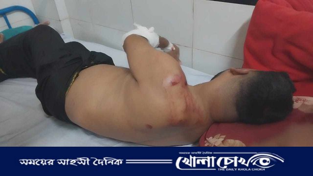 ভাঙ্গায় জব্দকৃত বালু টেন্ডারকে কেন্দ্র করে হামলাঃ ফাকাঁ গুলি,  বিএনপির ৪ নেতা- কর্মী আহত- এলাকায় চরম উত্তেজনা-পুলিশ মোতায়েন