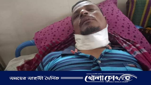 নগরকান্দায় ভ্যান চালককে গলা কেটে হত্যার চেষ্টা,থানায় অভিযোগ