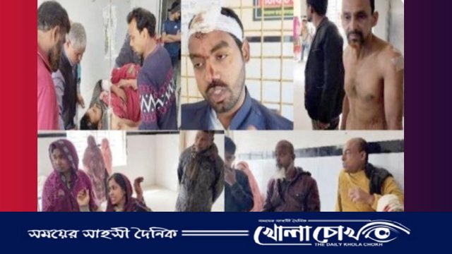 বোয়ালমারীতে তুচ্ছ ঘটনায় রক্তক্ষয়ী সংঘর্ষ, সাবেক কাউন্সিলরসহ আহত ২০