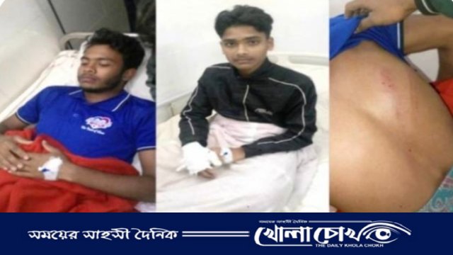 পিরোজপুরে নিষিদ্ধ ছাত্রলীগের হামলায় ৩ শিবির নেতা আহত