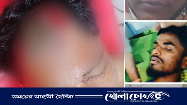 লামায় পৃথক সংঘর্ষে ১৫ জন আহত, লুটপাটের অভিযোগ